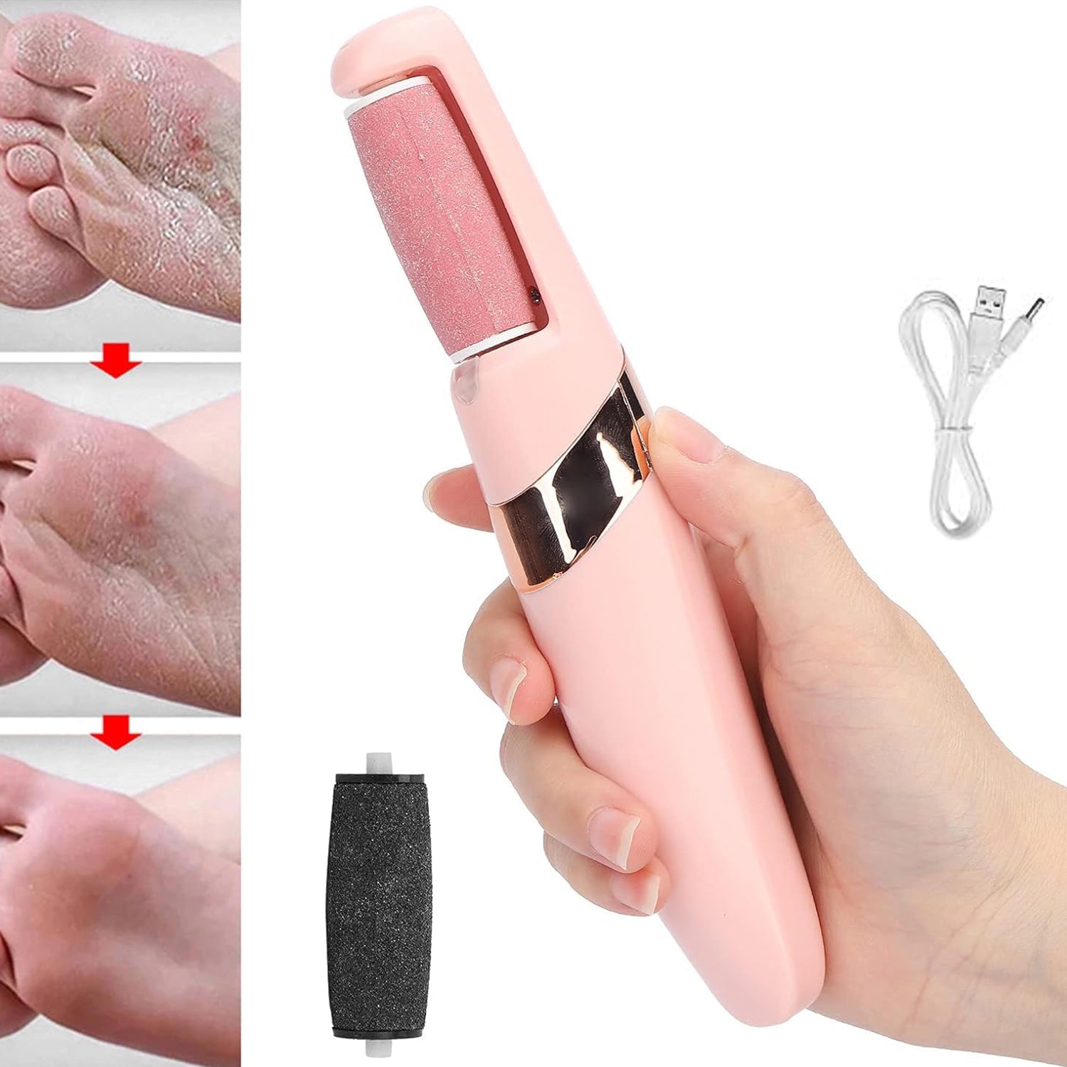 01_dd110c15-b097-40a2-af3d-47f85a6f01b3.jpg Rehbarlane Flewless Pedi Electronic Pedicure Tool (1 Set) - Image 1
